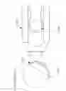 Fig. 13 - Surface plasmon resonance based nanoliter tear osmometer