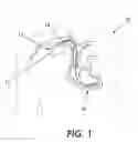 Fig. 02 - Electromagnetic interference immune tissue invasive system