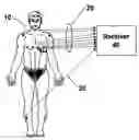 Fig. 01 - Synthesizing a reference value in an electrocardial waveform