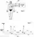 Fig. 02 - Synthesizing a reference value in an electrocardial waveform