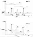 Fig. 03 - Synthesizing a reference value in an electrocardial waveform