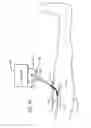 Fig. 11 - Temperature sensing system with retrograde sensor