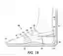 Fig. 16 - Method and apparatus for assisting vascular flow through external compression synchronized with venous phasic flow