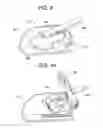 Fig. 10 - Cervical brace