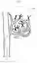 Fig. 08 - Infusion therapy