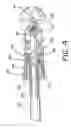 Fig. 05 - Variable angle orthopaedic reamer driver