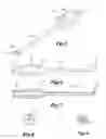 Fig. 03 - Ophthalmic irrigation-aspiration system