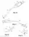 Fig. 04 - Ophthalmic irrigation-aspiration system