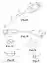 Fig. 07 - Ophthalmic irrigation-aspiration system