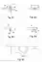 Fig. 04 - Fluid jet surgical instruments