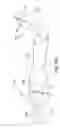 Fig. 12 - Fluid jet surgical instruments