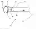Fig. 01 - Funnel catheter device and method of operation thereof
