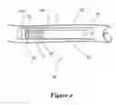 Fig. 05 - Funnel catheter device and method of operation thereof