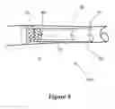 Fig. 10 - Funnel catheter device and method of operation thereof