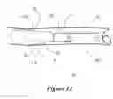 Fig. 13 - Funnel catheter device and method of operation thereof