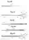 Fig. 07 - Endovascular guidewire filter and methods of use