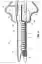 Fig. 15 - Electrosurgical stapling apparatus