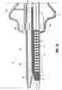 Fig. 17 - Electrosurgical stapling apparatus