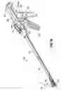 Fig. 20 - Electrosurgical stapling apparatus