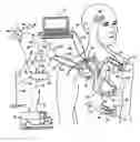 Fig. 01 - Virtual remote monitor, alert, diagnostics and programming for implantable medical device systems