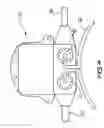 Fig. 06 - Cochlear implant having a repositionable implantable housing