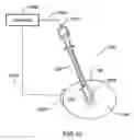 Fig. 07 - Electrosurgical device with improved visibility