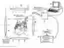 Fig. 01 - Method and apparatus for cardiac ablation