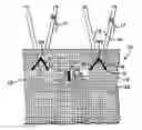 Fig. 01 - Multiple stitches for attaching stent to graft