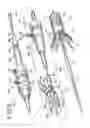 Fig. 04 - Multiple stitches for attaching stent to graft