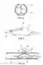 Fig. 03 - Implantable medical devices for treating or preventing restenosis