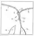 Fig. 01 - Devices and methods for repairing cardiac valves