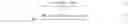 Fig. 02 - Method for measuring absolute steering angle of steering shaft of vehicle