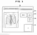 Fig. 04 - Radiographic apparatus, and control method and program thereof
