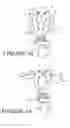Fig. 09 - Decoy and movement system