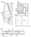 Fig. 03 - Wall structure system