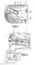 Fig. 02 - Mounting fixture and drum assembly