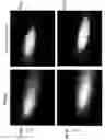 Fig. 09 - Superresolution ultrasound