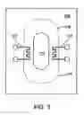 Fig. 06 - Implantable pressure sensors
