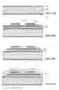 Fig. 33 - Implantable pressure sensors