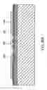 Fig. 43 - Implantable pressure sensors