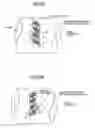 Fig. 04 - Torque sensor