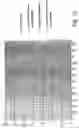 Fig. 07 - Shape memory alloy actuator