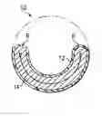 Fig. 01 - Collapse tolerant flexible pipe and method of manufacturing same