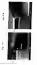 Fig. 08 - Dry etching method and apparatus