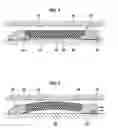 Fig. 02 - Annular barrier tool