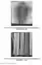 Fig. 08 - Electrochemical deposition process for composite structures