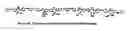 Fig. 09 - Electrochemical deposition process for composite structures