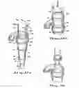 Fig. 09 - Cyclone with in-situ replaceable liner mechanisms and methods for accomplishing same