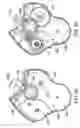 Fig. 08 - Medicament dispenser