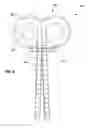 Fig. 07 - Protection device stem design